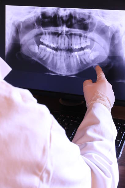 Best Emergency Denture Repair in Rockwell City, IA
