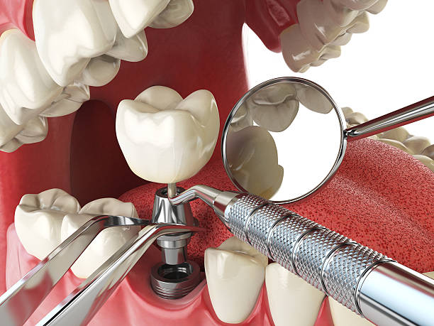 Best Emergency Root Canal Therapy in Rockwell City, IA